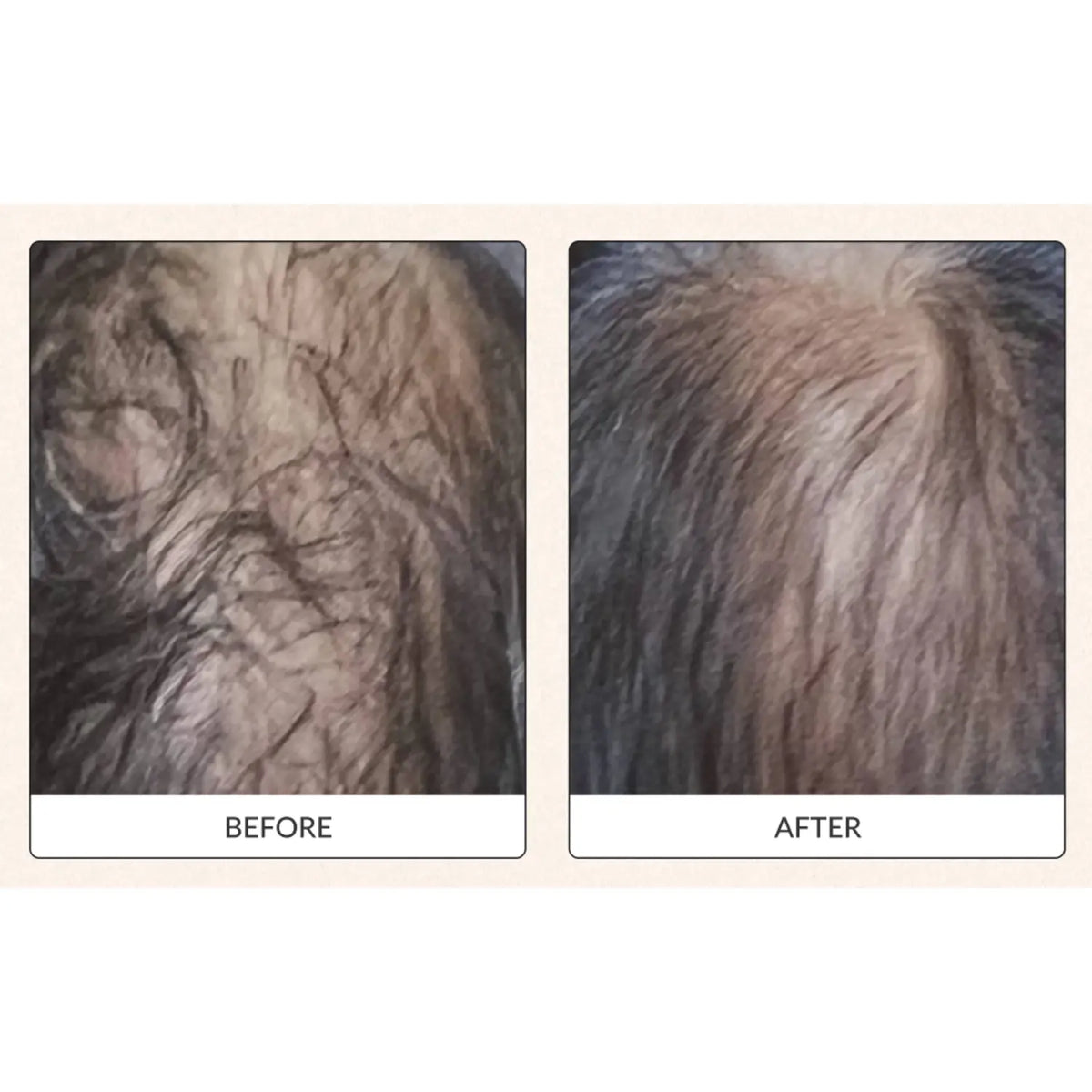 Vitality Line Shampoo